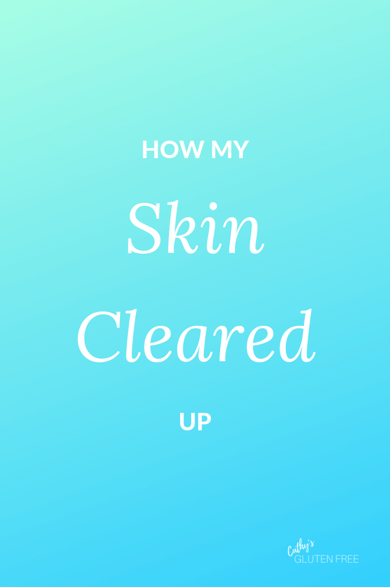 How My Skin Cleared Up